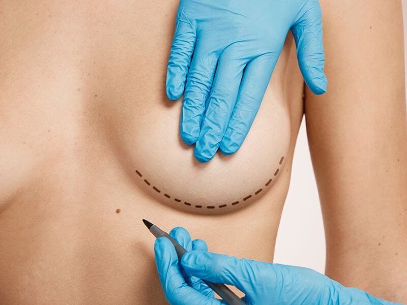 Breast Esthetic