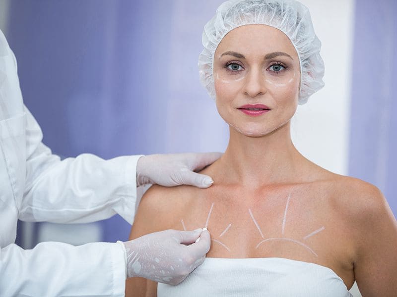 Breast Reduction