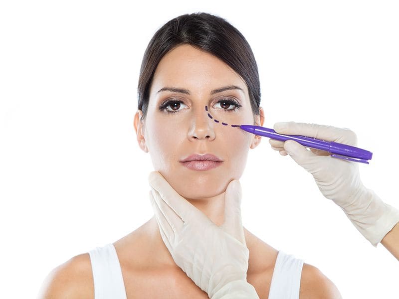 Eye Lid Surgery