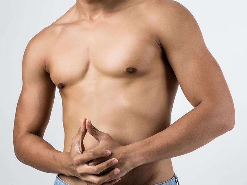 Gynecomastia