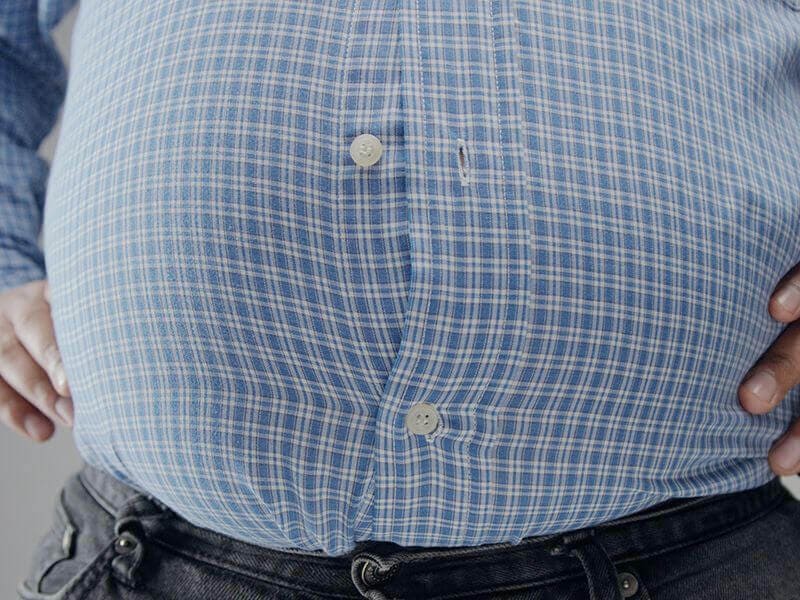 Obesity Surgery